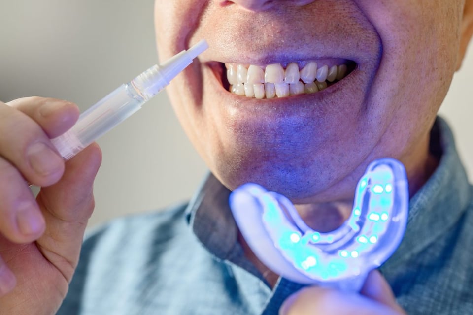 Así es la tecnología dental que cambia tu sonrisa sin gastar de más!