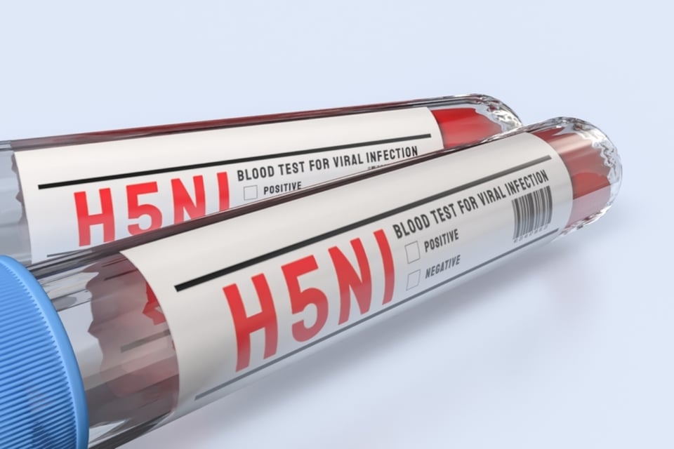 Muere el primer paciente infectado con la cepa H5N5 de gripe aviar en Estados Unidos