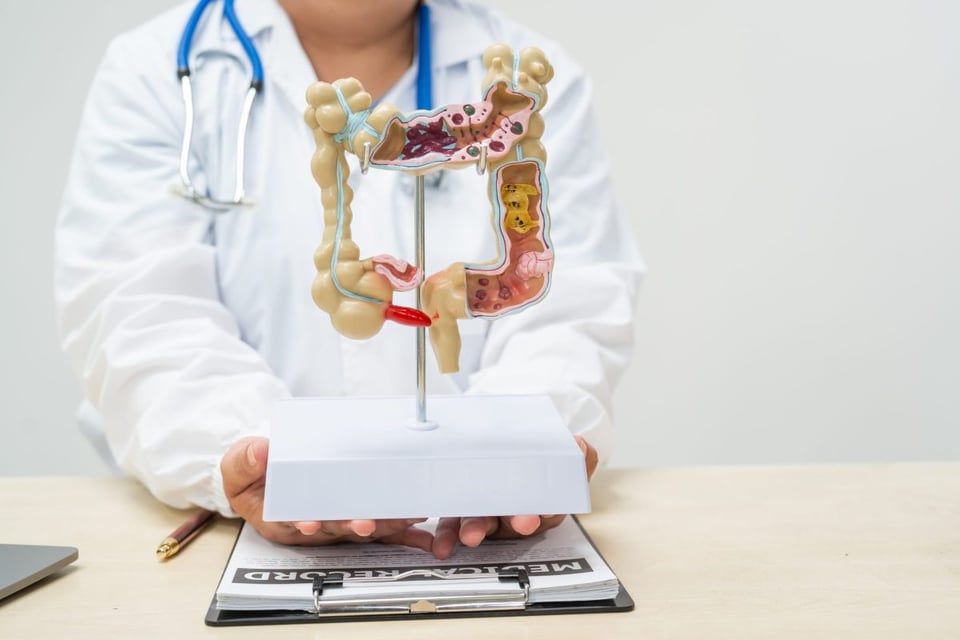 estrenimiento , doctor, medicos, tratamiento