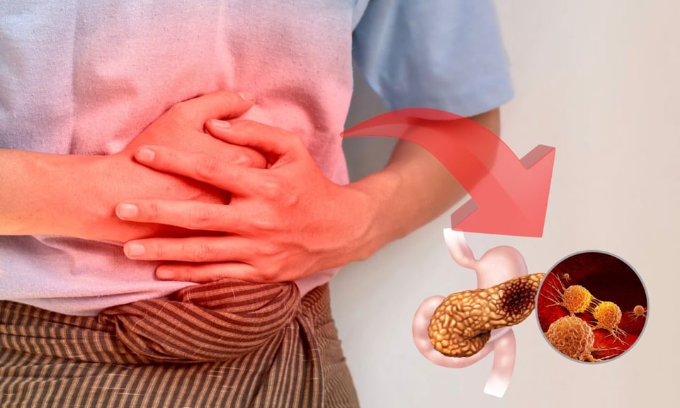 ¿Sabes qué es la pancreatitis? Aprende a identificar los hábitos diarios que afectan tu páncreas!