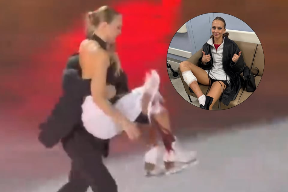Patinadora Victoria Sinitsina sufre corte en la pierna durante show