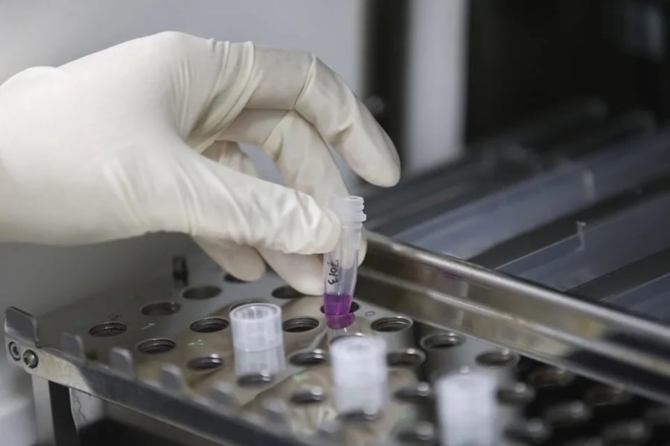 CDC, hantavirus, EE.UU. MundoNOW, MV Hondius hantavirus monitoring