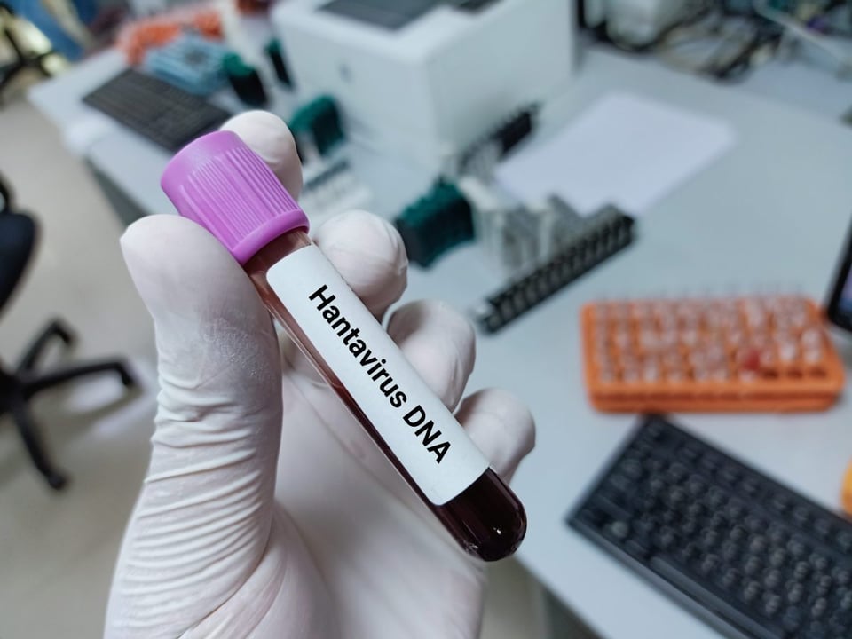hantavirus, ratones, virus, sintomas, enfermedad