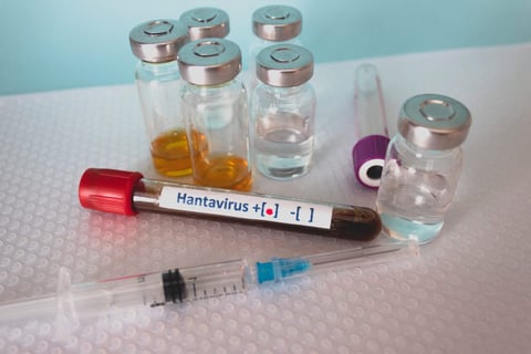 Vitaminas y hábitos que refuerzan tu sistema inmunológico ante el brote de Hantavirus