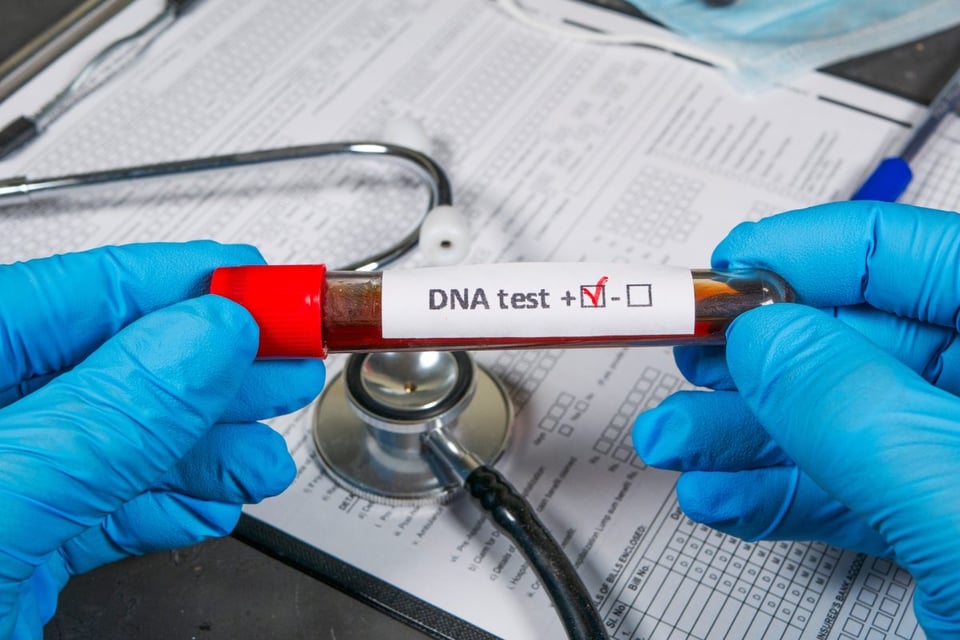 ADN, DNA, test, cadaver, misterio, hallazgo, descubrimiento