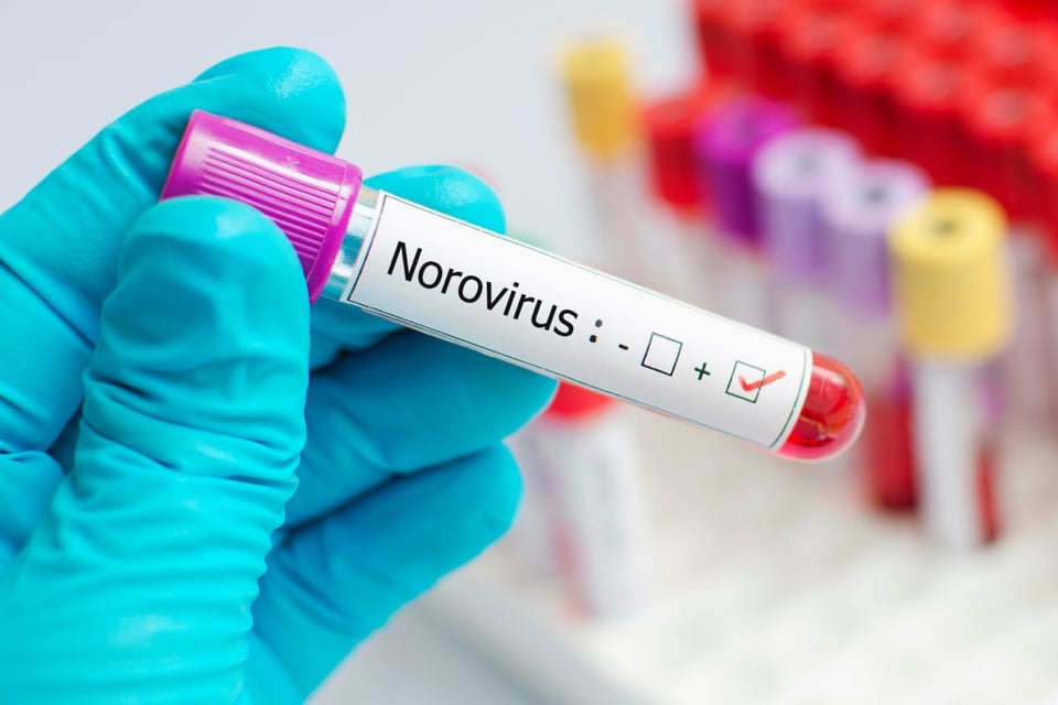 Norovirus golpea crucero en California: más de 100 contagios en pleno viaje