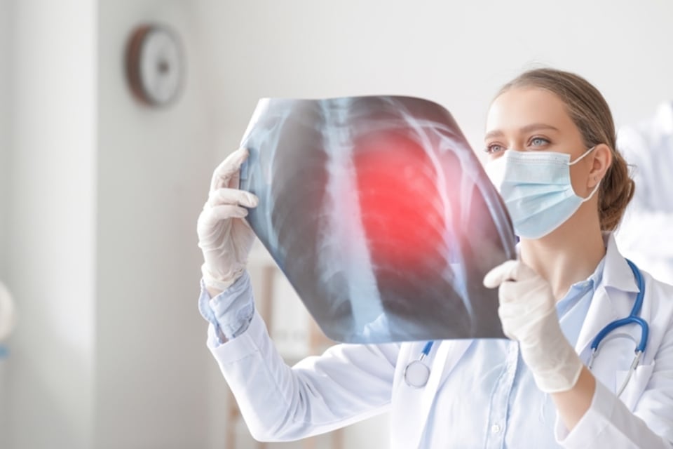 Tuberculosis en centro de inmigrantes