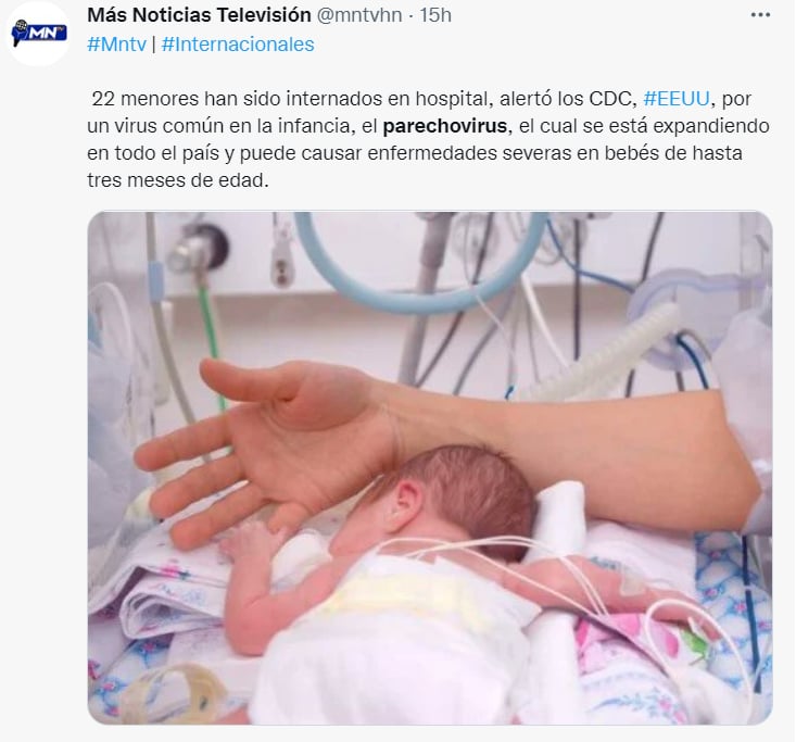 Internan bebés por parechovirus: ¿Qué síntomas presentaron?