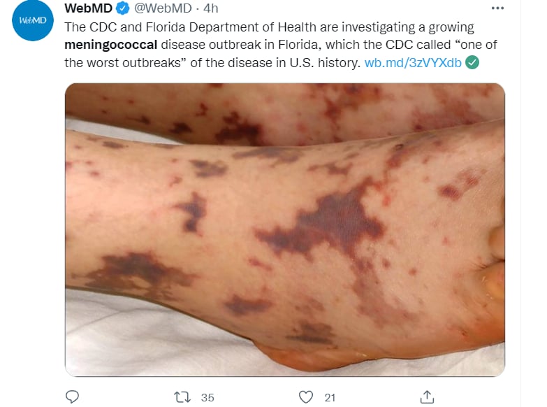 CDC advierte bacteria Florida: ¿Qué pidieron los CDC?