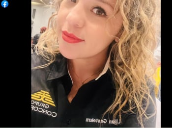 MUERE TRAS PRACTICARSE UNA CIRUGÍA ESTÉTICA