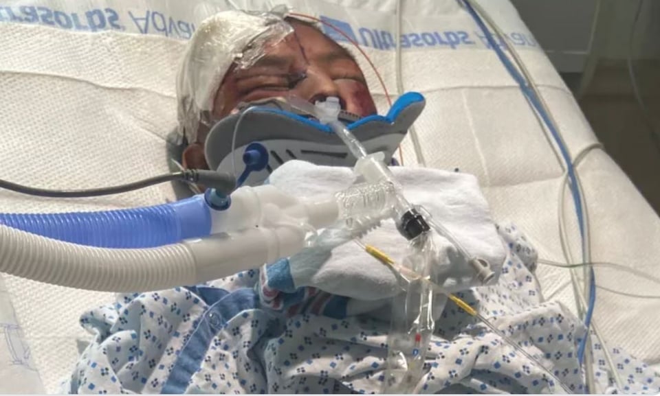 Niño hispano atropellado en Ramapo