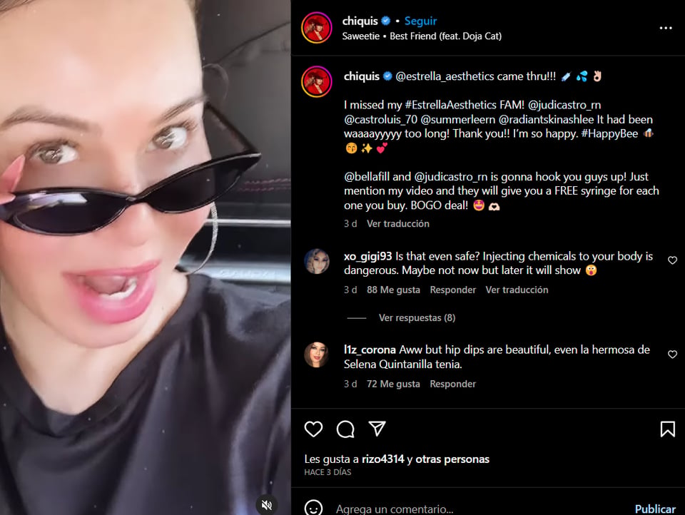 Chiquis Rivera tratamiento estético: "Dejen la envidia"