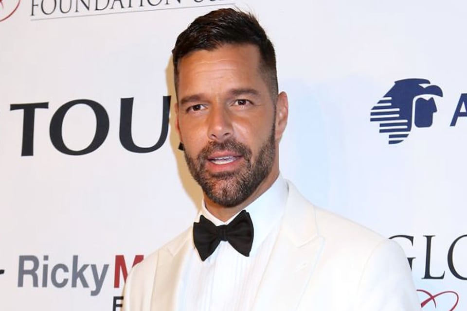 Ricky Martin’s ‘new’ face is said to be due to an allergic reaction and not botox