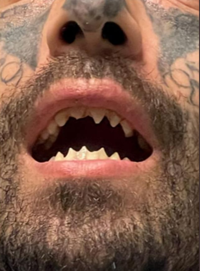 Michael Barajas la amenazó con sus afilados dientes