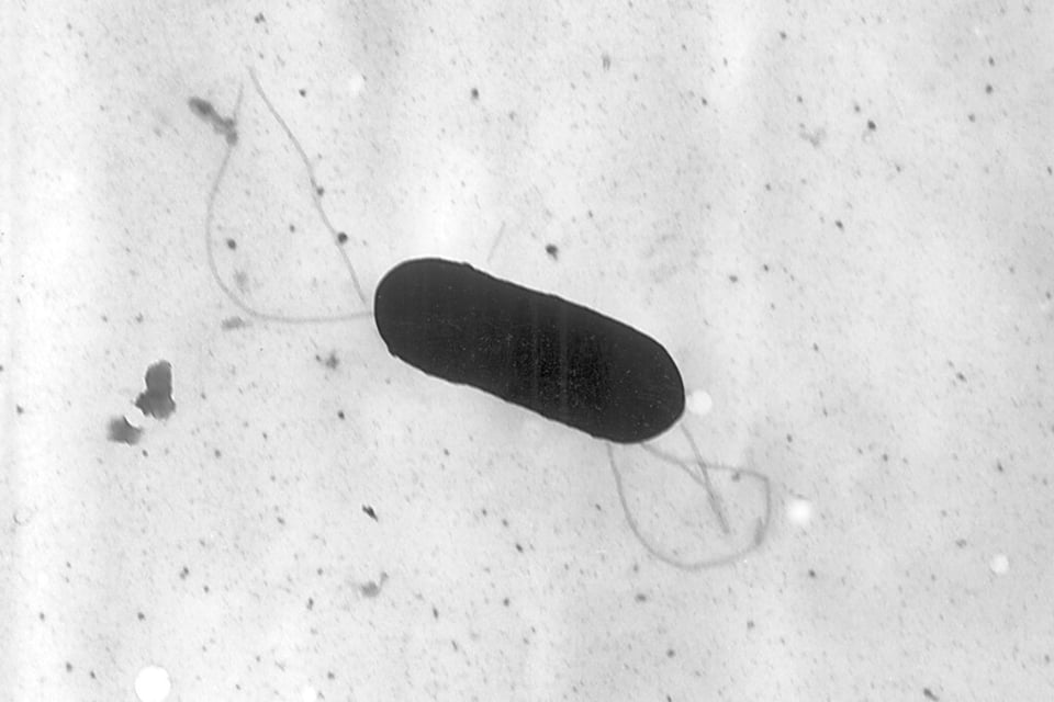 Brote de listeriosis deja un muerto y 23 hospitalizados: piden estar alerta a los síntomas