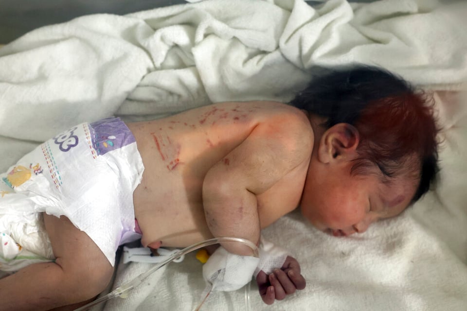 A beautiful baby who managed to stay alive in the rubble
