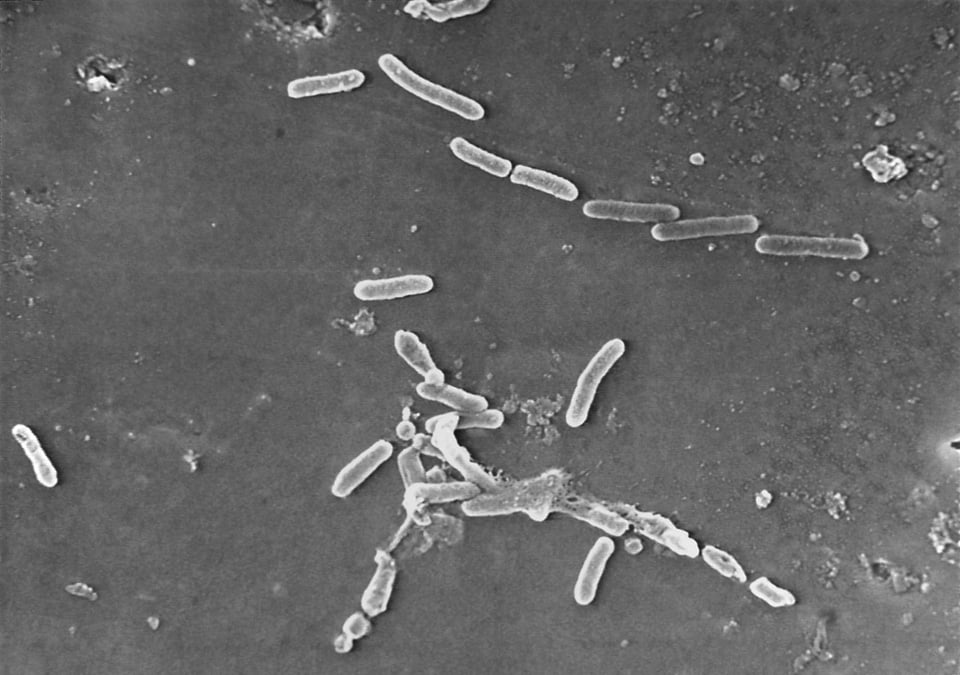 El anuncio surge tan sólo unos días después de que la FDA emitiera otro recall urgente