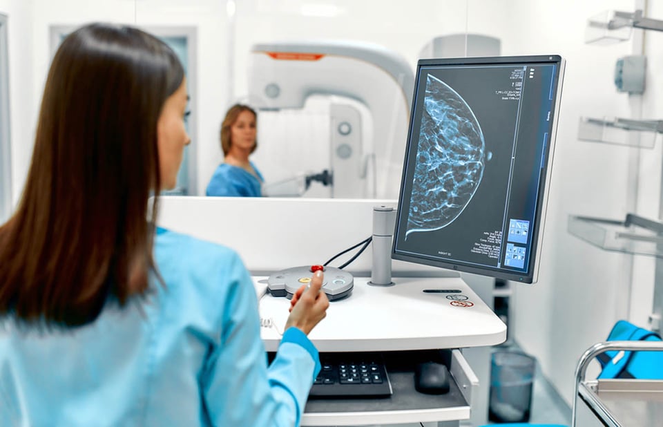 cáncer de mama, riesgos, mamografía, médico, hospital