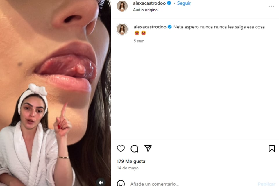 Noticia, Famosos, Impacto, Salud, Diagnóstico