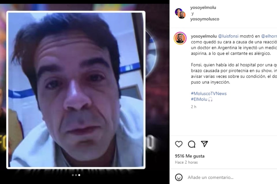 Reactions, Reviews, Luis Fonsi, Artist, Allergy