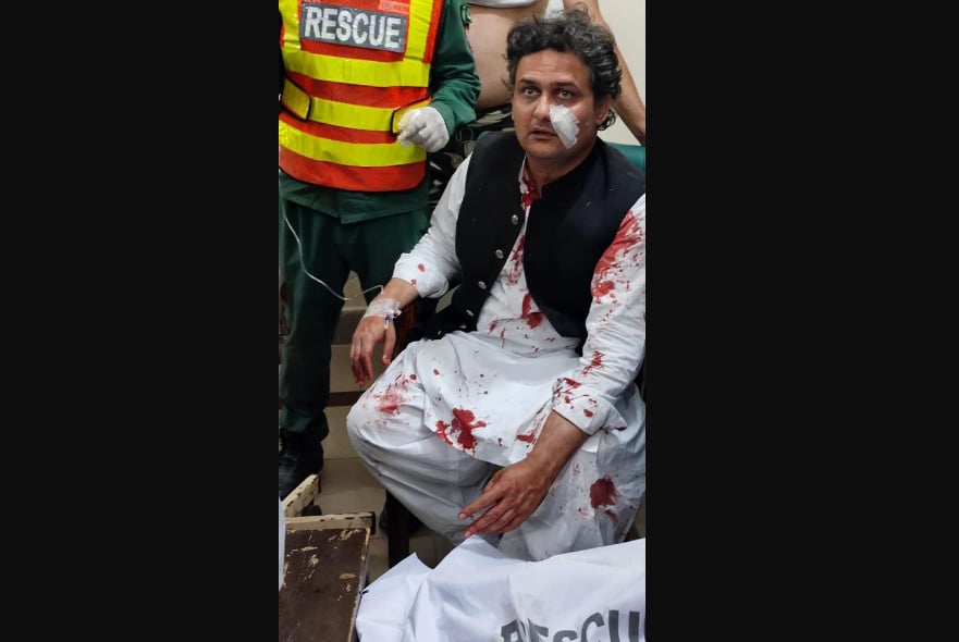 Sufrió ataque con armas en Pakistán