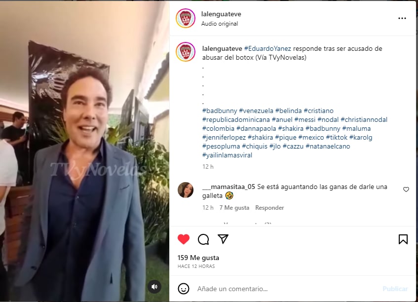 Usuarios lo llenaron de criticas: "Parece un muñeco de goma"