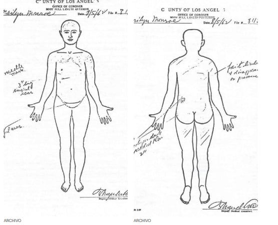 No había signos de violencia en el cuerpo de Monroe