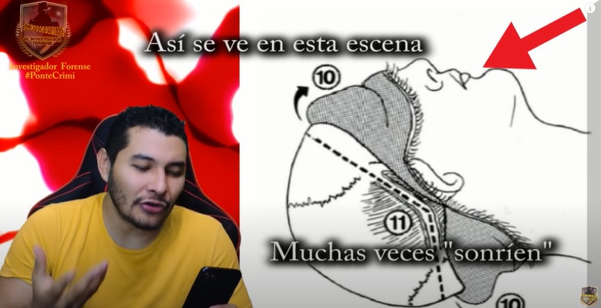 Was Valentín Elizalde smiling in his autopsy?