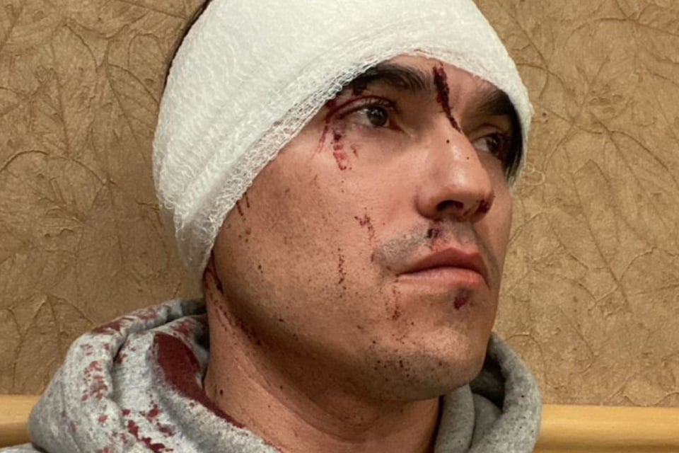 Elotero hispano recibe brutal ataque mientras trabajaba (FOTOS)