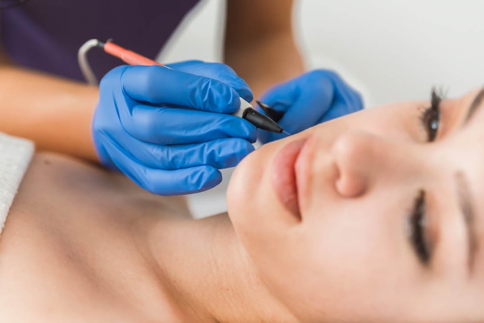 Electrolysis, Dermatologist, woman, skin, hair removal, tips