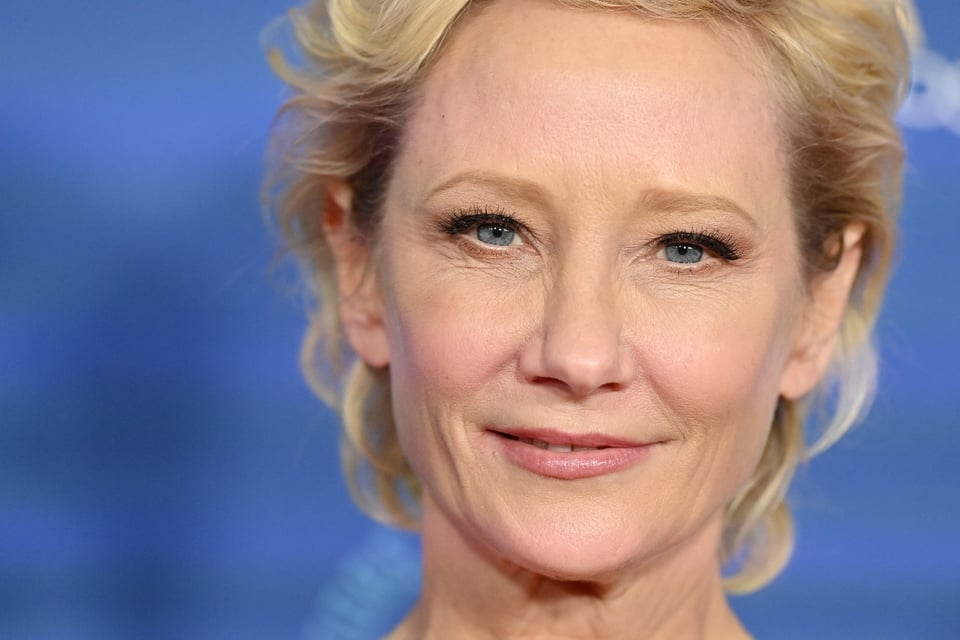 Actress Anne Heche is in critical condition after a car accident (PHOTOS)