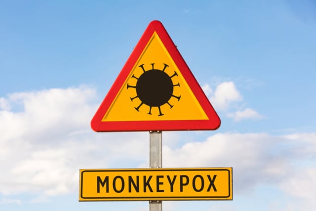 WHO declares highest alert over monkeypox outbreak