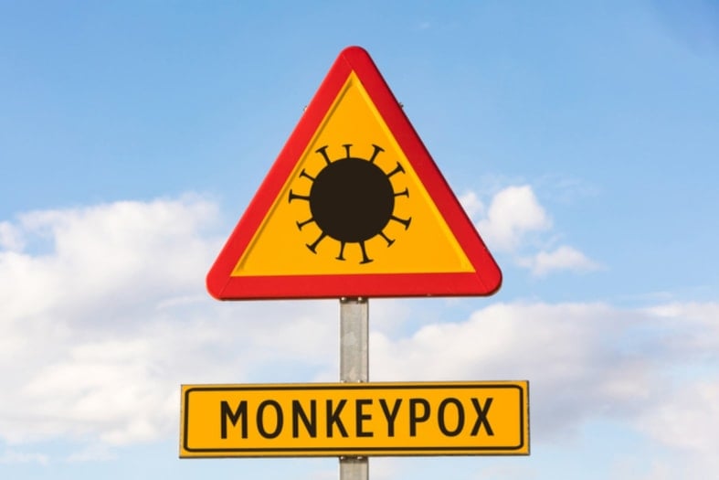 What is the treatment for monkeypox?
