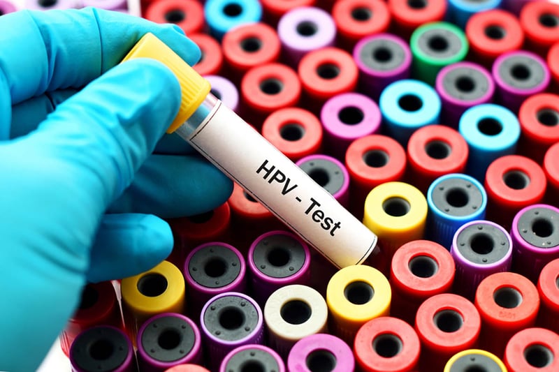 health, screenings, test, science, disease