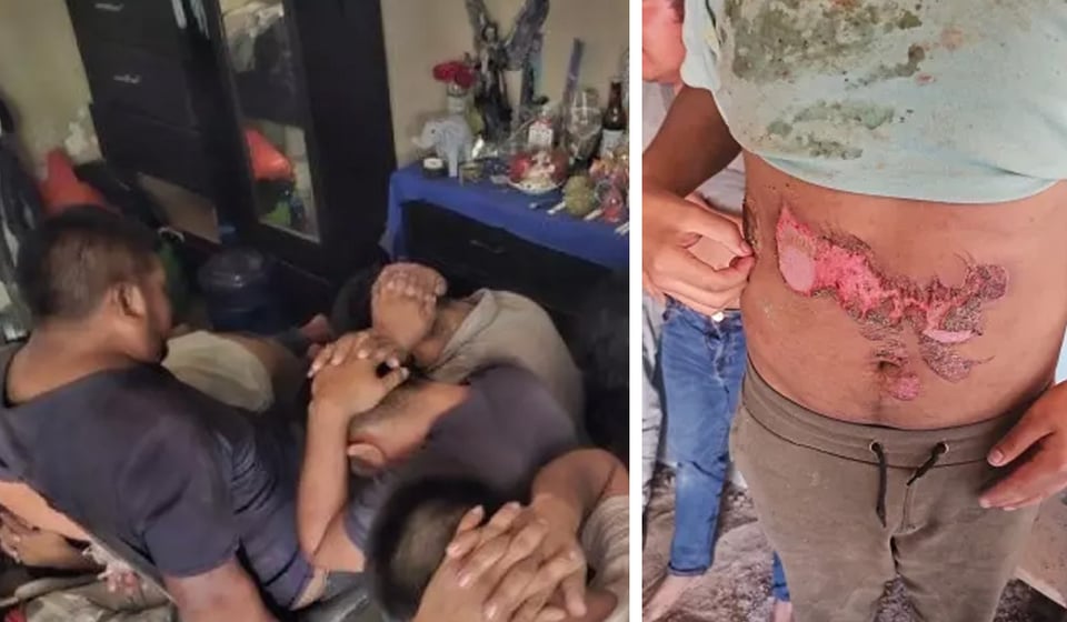 13 immigrants tortured and burned by cartels rescued on the Mexican border