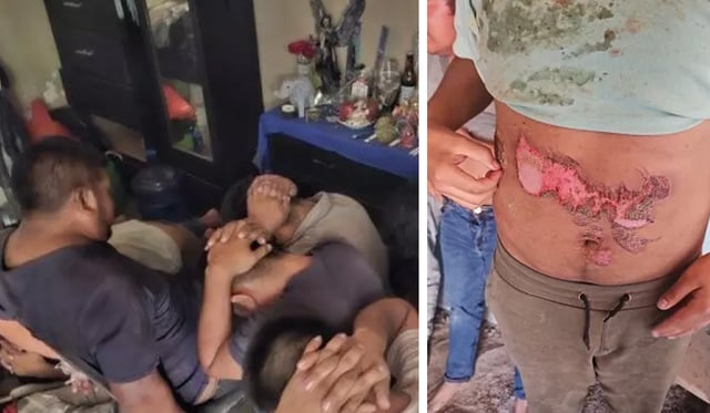 13 immigrants tortured and burned by cartels rescued on the Mexican border