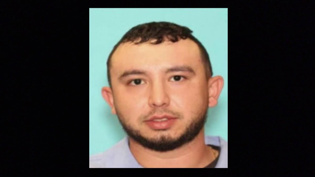 ¿Quién atacó a Joshua Sandoval hasta casi desfigurarlo? (FOTOS)