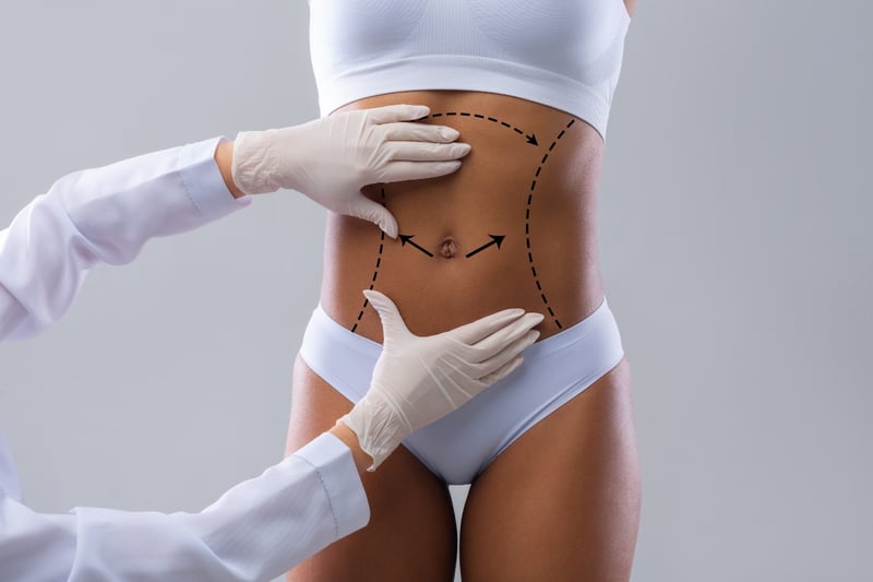 Mother of 5 dies after liposuction performed by fake doctors in Mexico