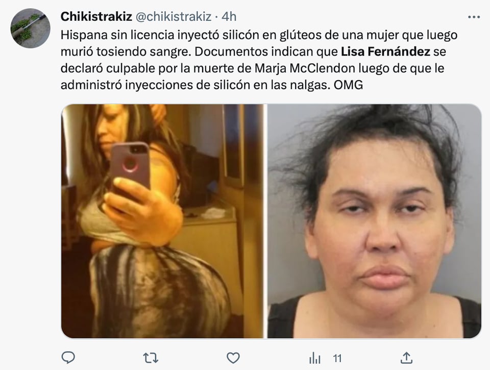 Lisa Fernández said she was a 
