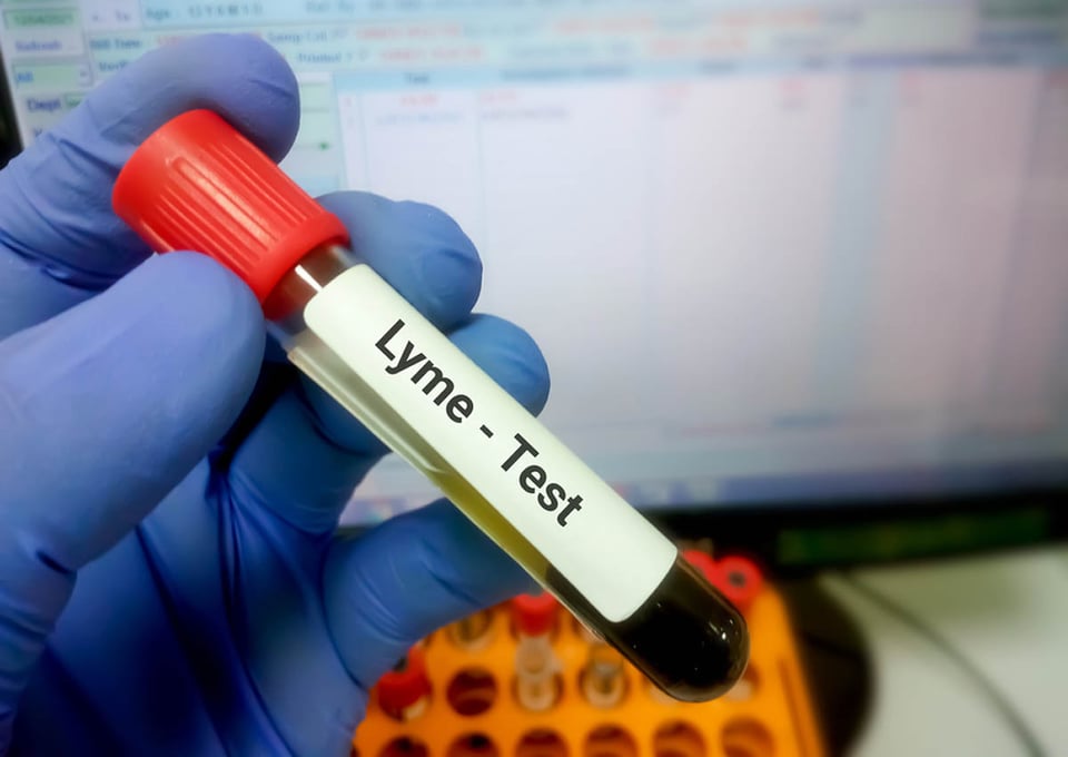 Muestra de sangre, enfermedad de Lyme, pruebas. laboratorio, mundonow
