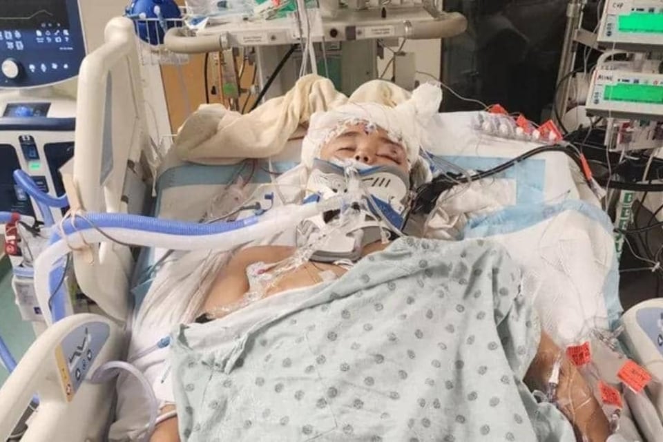 Muere niño tras ser arrollado camino a su escuela