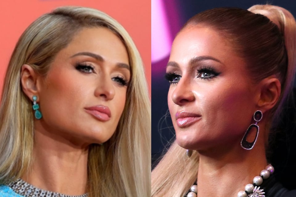 Paris Hilton’s photos of her new baby spark concern about the size of his head