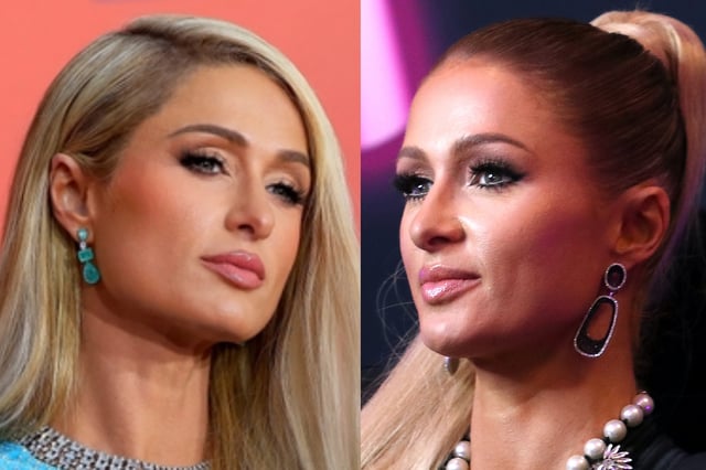 Paris Hilton’s photos of her new baby spark concern about the size of his head