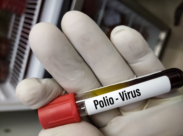 Detectan virus de polio en aguas cloacales en Nueva York