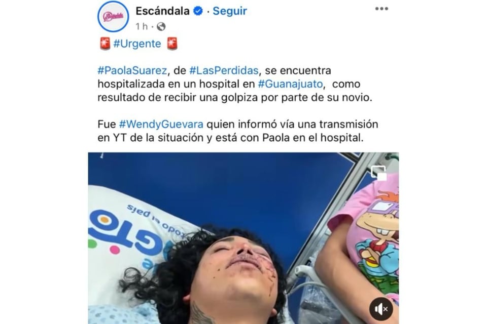golpe, rostro, amigas, cirugía, MundoNow