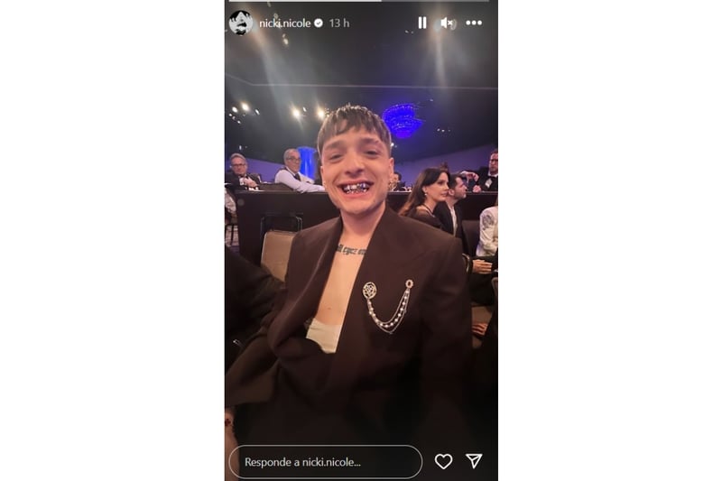 Critican dientes Peso Pluma, corridos tumbados, Grammy, MundoNOW