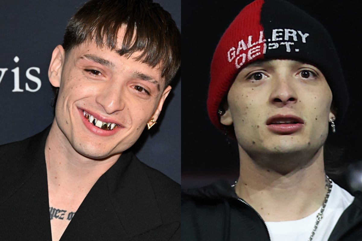 Critican a Peso Pluma por extravagante cambio en sus dientes