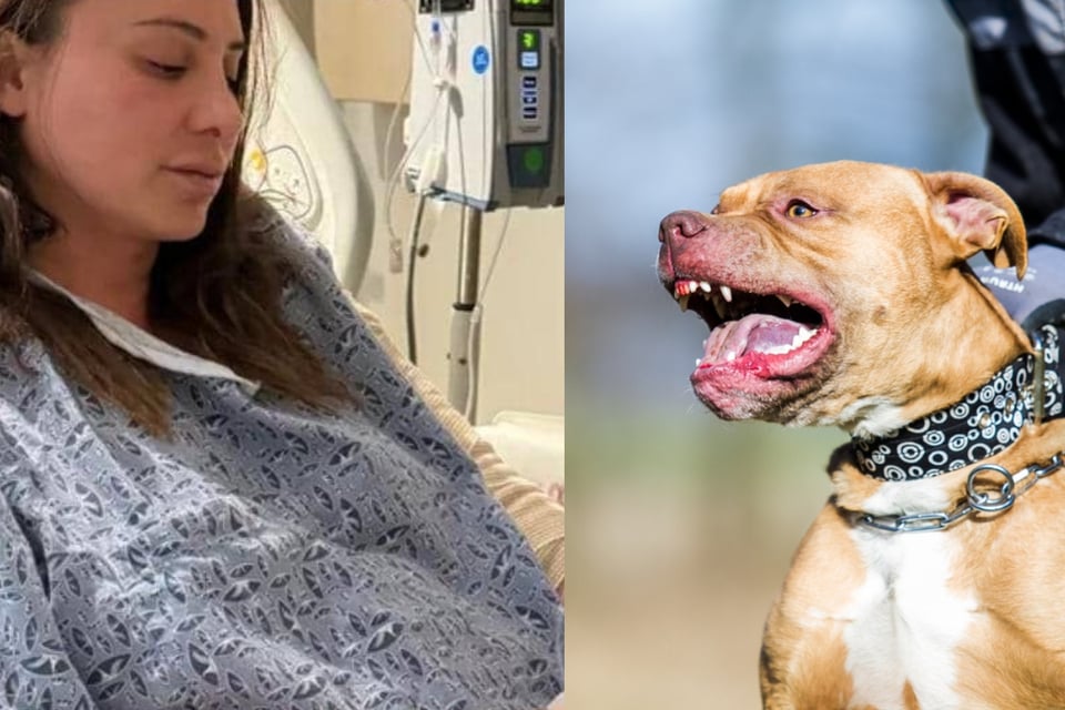 Mujer atacada por un pitbull casi pierde un brazo