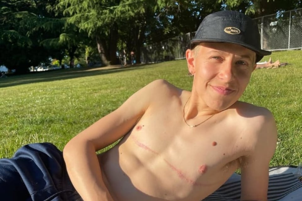 mastectomy, breasts, transition, non-binary pronouns, MundoNOW
