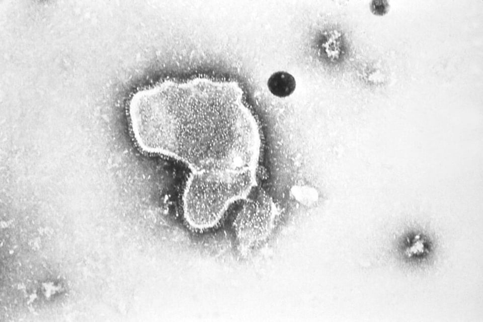 ¿Cómo proteger a los niños del RSV?